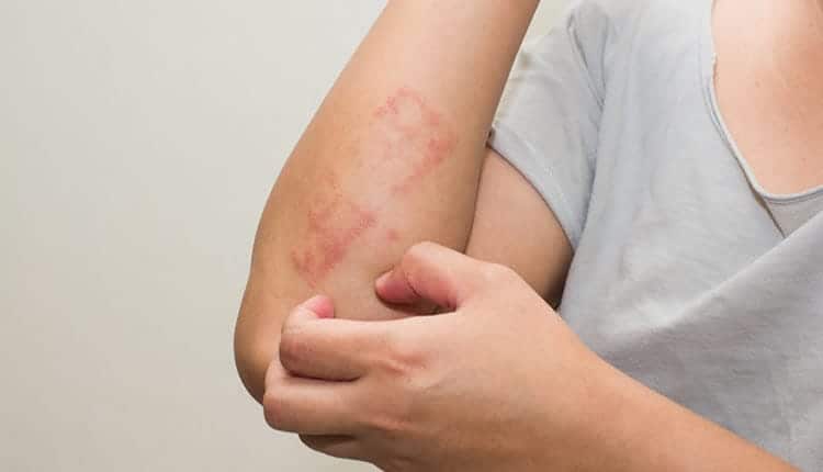 skin-lesions